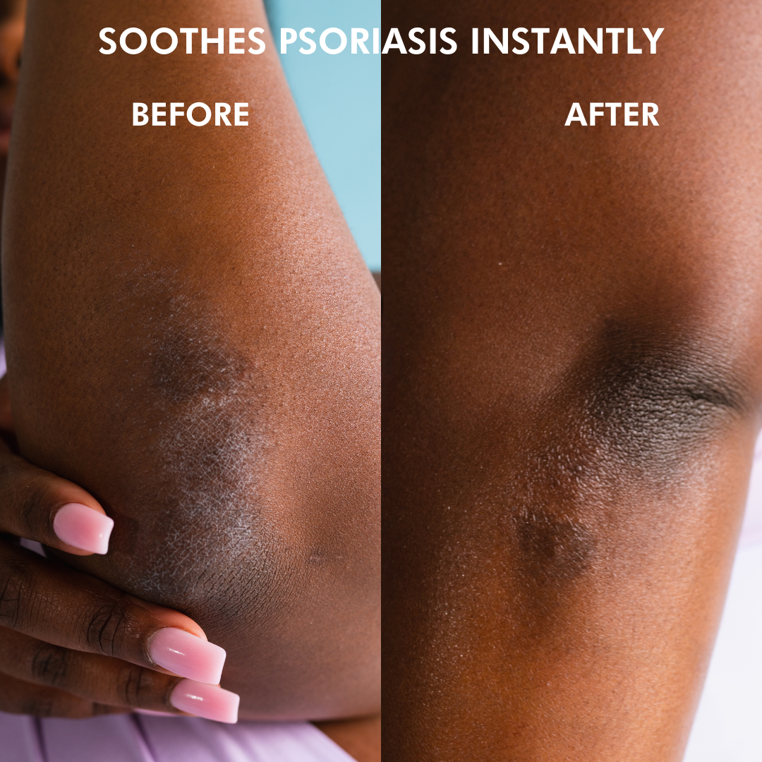 African Beauty Butter: Intensive Dry Skin Treatment
